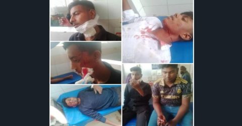 সিরাজগঞ্জের বেলকুচিতে স্কুলের দরোয়ানের সাথে কথা কাটাকাটি ছুরিকাঘাতে আহত ৪ শিক্ষার্থী হাসপাতালে