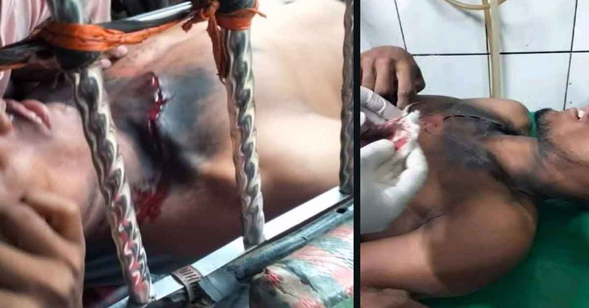 শ্রীমঙ্গলে বজ্রপাতে মারাত্মক আহত বাবা-ছেলে