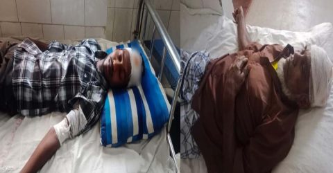 বানারীপাড়ার উদয়কাঠীতে আপন ভাইয়ের ধারালো দায়ের কোপে ভাই ও ভাতিজা গুরুতর আহত