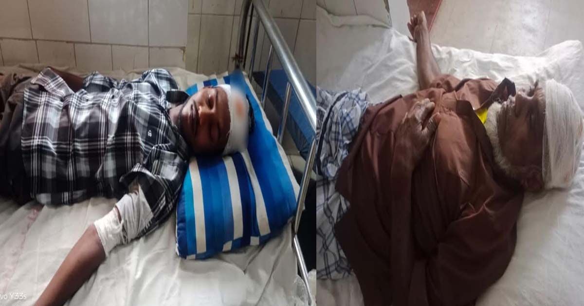 বানারীপাড়ার উদয়কাঠীতে আপন ভাইয়ের ধারালো দায়ের কোপে ভাই ও ভাতিজা গুরুতর আহত