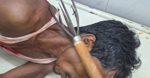 বাঞ্ছারামপুরে জমি সংক্রান্ত এবং আম পারতে যেয়ে টেটাবিদ্ধ ২