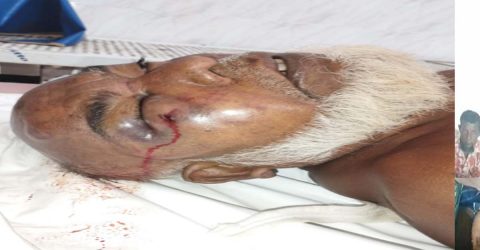 নোয়াখালীতে ৬৫ বছরের বৃদ্ধাকে পিটিয়ে হ*ত্যা