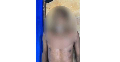 শ্যামনগরে গাছ থেকে পড়ে এক শ্রমিকের মৃত্যু
