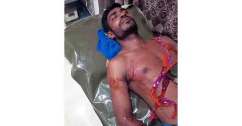 বটিয়াঘাটায় পরকীয়ার জেরে স্বামীকে হত্যা চেষ্টা