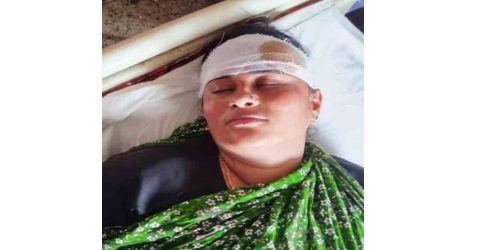 গোপালগঞ্জে স্বজন দেখতে এসে হামলার শিকার, অভিযোগ ভুক্তভোগীদের