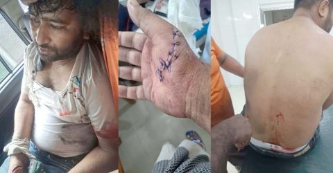 বোয়ালমারীতে মাটি চোরদের হামলায় ইটভাটা ম্যানেজার মারাত্মক আহত