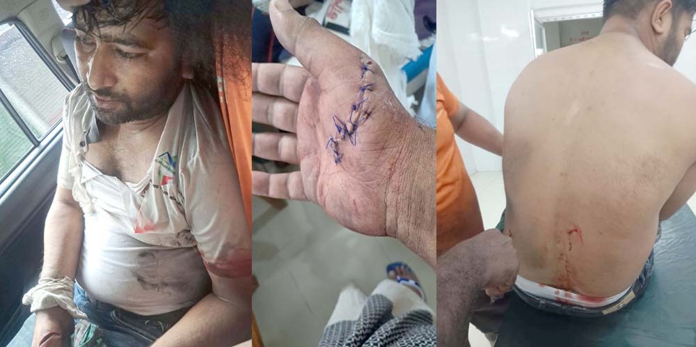 বোয়ালমারীতে মাটি চোরদের হামলায় ইটভাটা ম্যানেজার মারাত্মক আহত